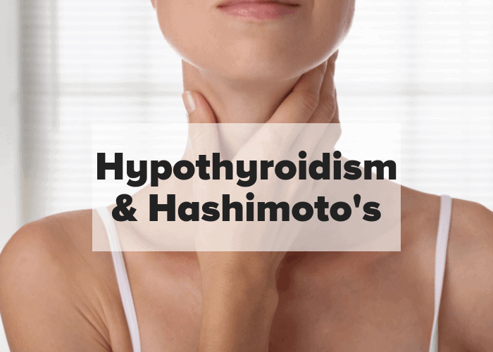 Hypothyroidism & Hashimoto's