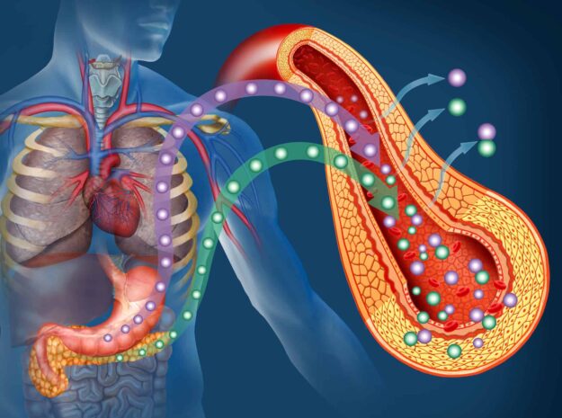 Insulin resistance